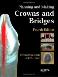 Planning and Making Crowns and Bridges 4th edition (pdf)